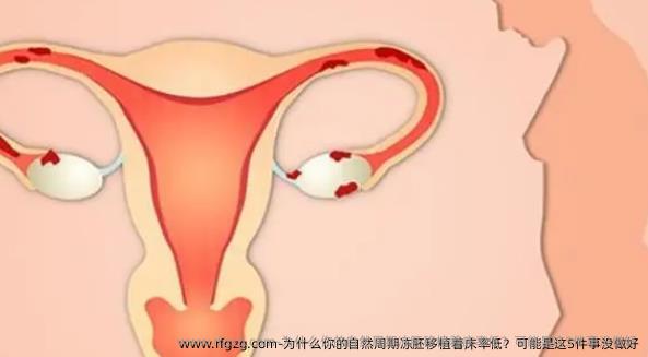 为什么你的自然周期冻胚移植着床率低？可能是这5件事没做好