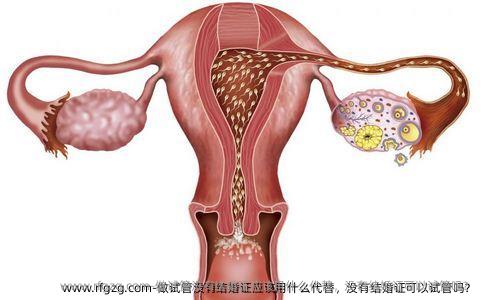 做试管没有结婚证应该用什么代替，没有结婚证可以试管吗？