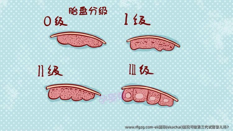 ek国际(ekachai)医院可做第三代试管婴儿吗？