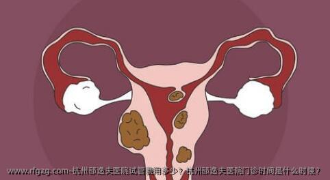 杭州邵逸夫医院试管费用多少？杭州邵逸夫医院门诊时间是什么时候？