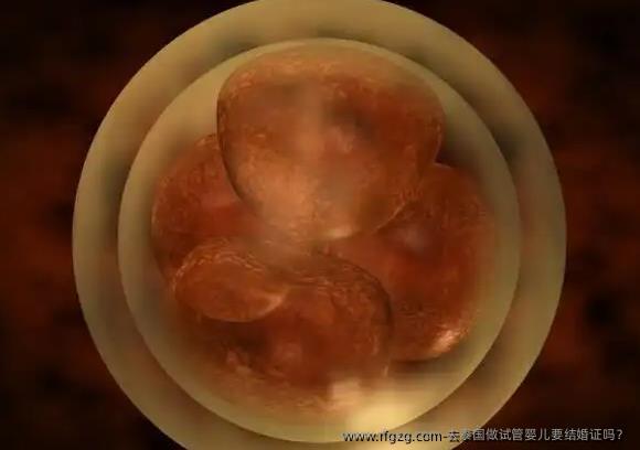 去泰国做试管婴儿要结婚证吗？