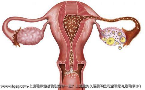 上海哪家做试管比较好一点？上海第九人民医院三代试管婴儿费用多少？
