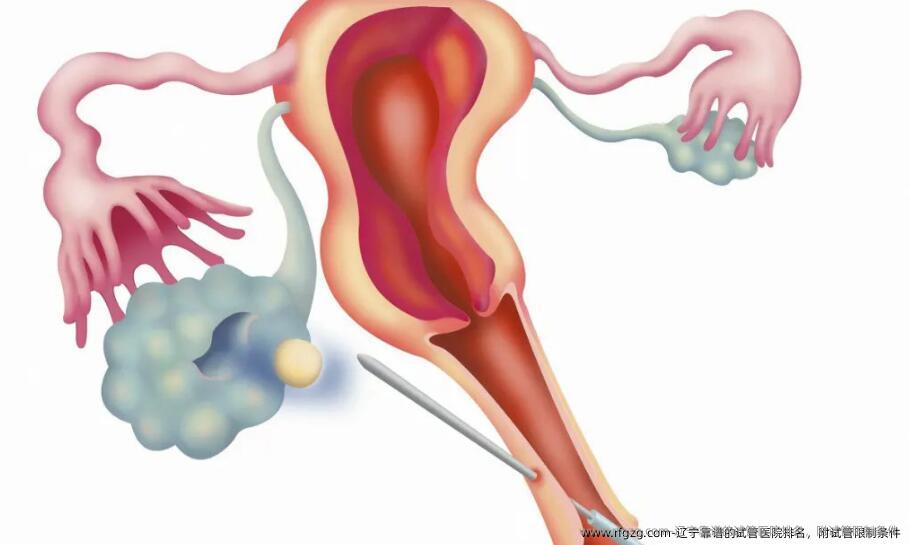 辽宁靠谱的试管医院排名，附试管限制条件