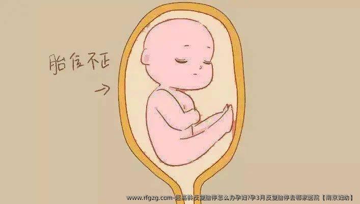 超高龄反复胎停怎么办孕妇?孕3月反复胎停去哪家医院【南京妇幼】