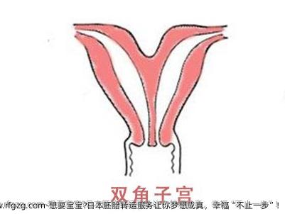想要宝宝？日本胚胎转运服务让你梦想成真，幸福“不止一步”！