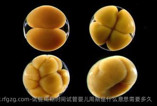 试管周期时间试管婴儿周期是什么意思需要多久