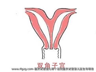 重庆试管婴儿哪个医院重庆试管婴儿医生有哪些