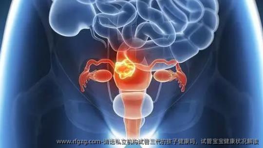 清远私立机构试管三代的孩子健康吗，试管宝宝健康状况解读