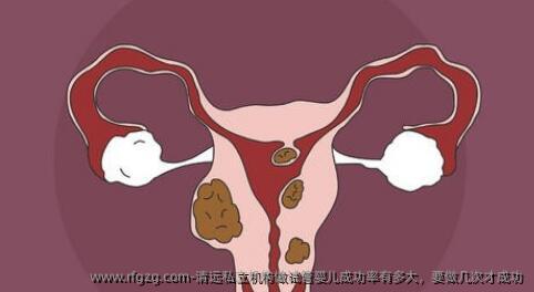 清远私立机构做试管婴儿成功率有多大，要做几次才成功