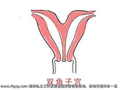 潮州私立三代试管基因筛查哪些疾病，疾病筛查列表一览