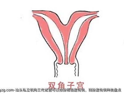 汕头私立机构三代试管可以排除哪些遗传病，排除遗传病种类盘点