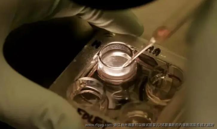浙江台州哪里可以做试管婴儿?试管囊胚的内细胞团是否越大越好