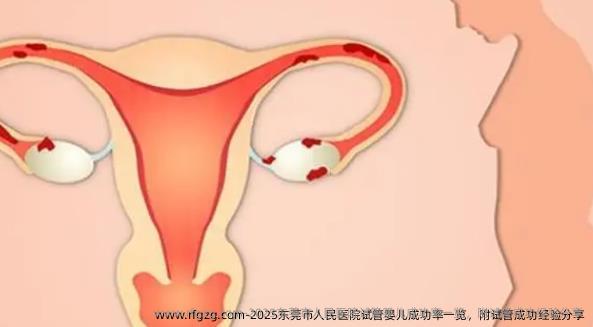 2025东莞市人民医院试管婴儿成功率一览，附试管成功经验分享