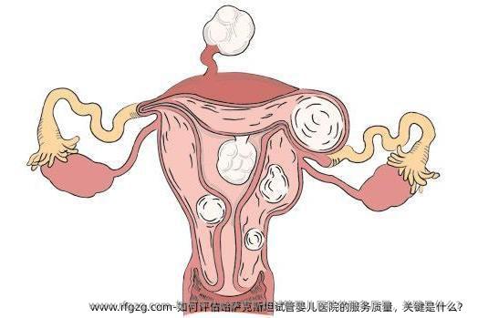 如何评估哈萨克斯坦试管婴儿医院的服务质量，关键是什么？