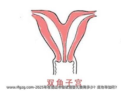 2025年在昆山市做试管婴儿费用多少？成功率如何？