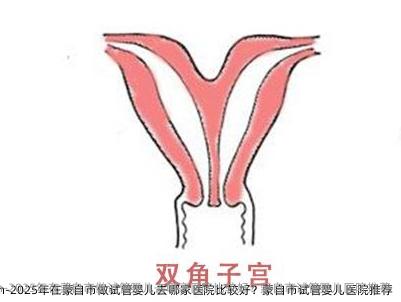 2025年在蒙自市做试管婴儿去哪家医院比较好？蒙自市试管婴儿医院推荐