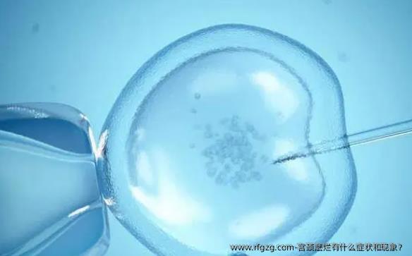 宫颈麽烂有什么症状和现象？