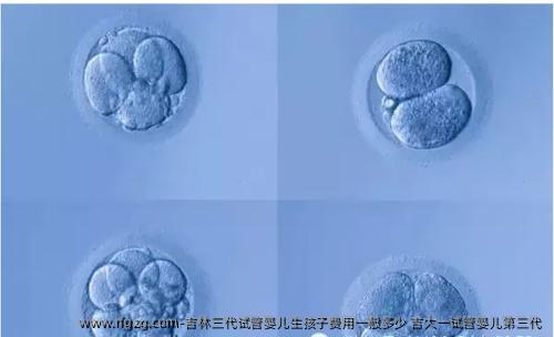 吉林三代试管婴儿生孩子费用一般多少 吉大一试管婴儿第三代