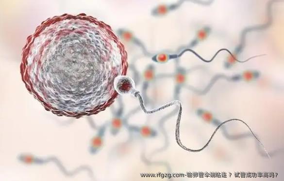 输卵管伞端粘连？试管婴儿成功率高吗？