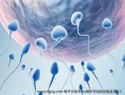 精子分离术中y精子筛选的价格是多少？