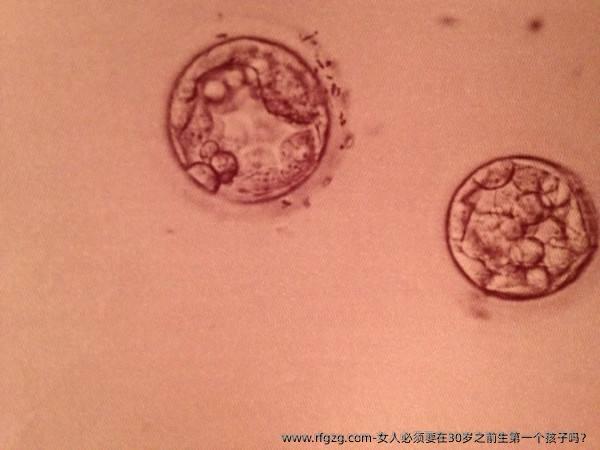 女人必须要在30岁之前生第一个孩子吗？