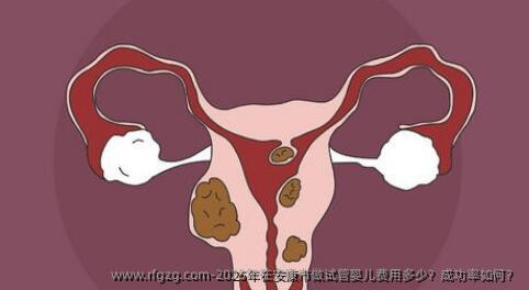 2025年在安康市做试管婴儿费用多少？成功率如何？