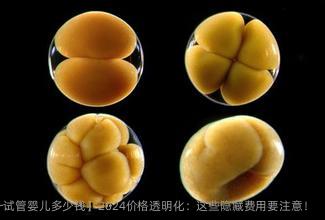 惠州【做一试管婴儿多少钱】2024价格透明化：这些隐藏费用要注意！