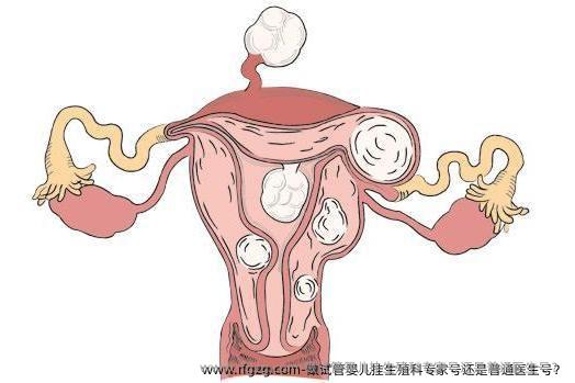 做试管婴儿挂生殖科专家号还是普通医生号？