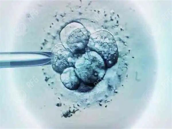 揭秘日本试管婴儿医院流程：专业、有效，助您成功