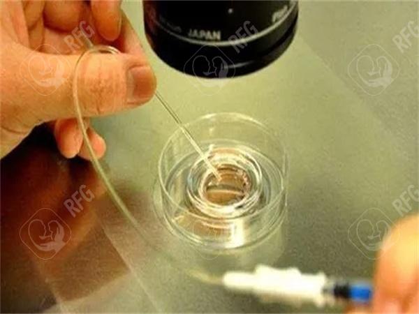 安徽试管费用透明吗？真实案例分享与建议