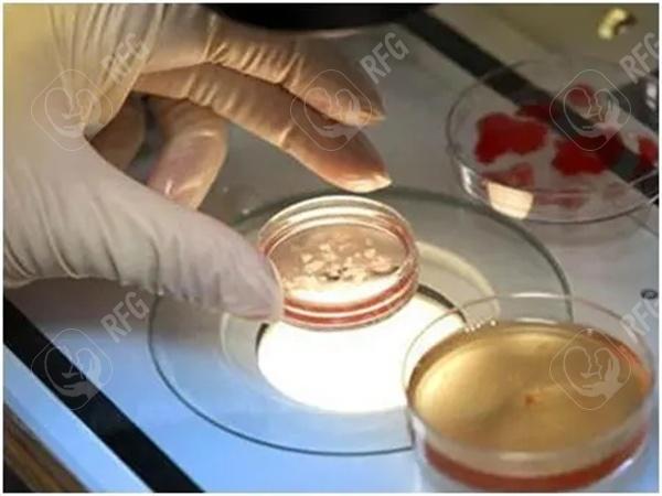 试管婴儿卵泡取出多少钱好？试管婴儿卵泡取出后内膜会变薄是真的吗？